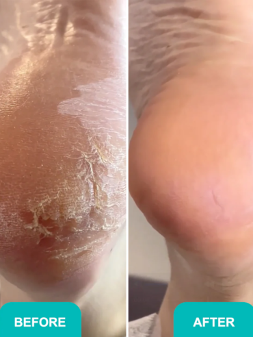 Foam_express_softener_for_pedicure_Soft_blade-2