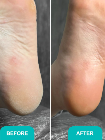 Foam_express_softener_for_pedicure_Soft_blade