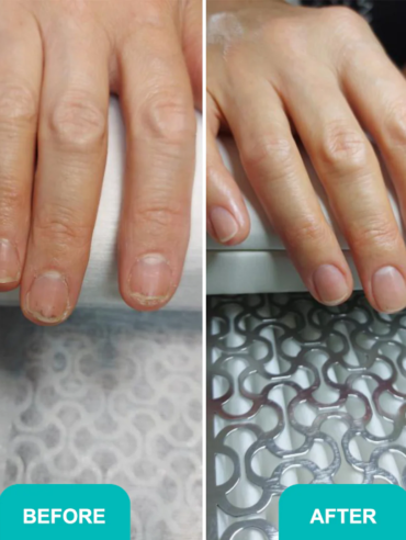 Oil_for_damaged_nail_plate-2